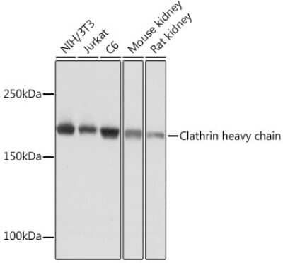 Western Blot: Clathrin Heavy Chain 1/CHC17 Antibody (9M2G2) [NBP3-16518]