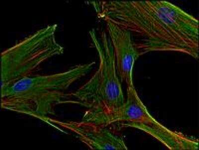 Immunocytochemistry/ Immunofluorescence: Clathrin Heavy Chain 1/CHC17 Antibody (BF-06) [NBP1-45050]