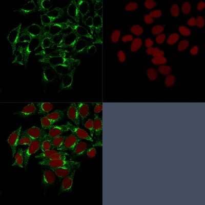 Immunocytochemistry/ Immunofluorescence: Clathrin Heavy Chain 1/CHC17 Antibody (CHC/1432) - Azide and BSA Free [NBP3-08333]