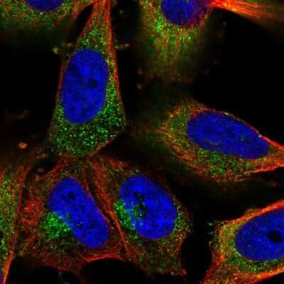 Immunocytochemistry/ Immunofluorescence: Clathrin Heavy Chain 1/CHC17 Antibody [NBP2-49293]