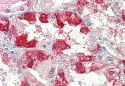 Immunohistochemistry-Paraffin: Clathrin Heavy Chain 1/CHC17 Antibody [NBP1-52529]