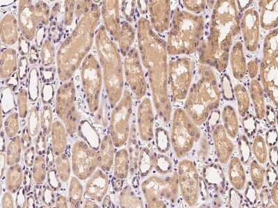 Immunohistochemistry-Paraffin: Clathrin Heavy Chain 1/CHC17 Antibody [NBP2-99308]