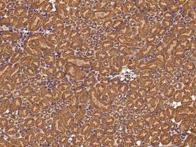 Immunohistochemistry-Paraffin: Clathrin Heavy Chain 1/CHC17 Antibody [NBP2-99308]