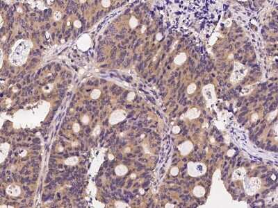 Immunohistochemistry-Paraffin: Clathrin Heavy Chain 1/CHC17 Antibody [NBP2-99308]