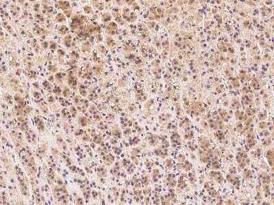 Immunohistochemistry-Paraffin: Clathrin Heavy Chain 1/CHC17 Antibody [NBP2-99308]