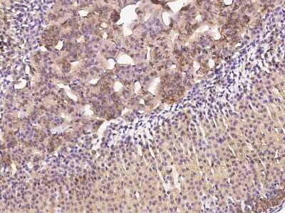 Immunohistochemistry-Paraffin: Clathrin Heavy Chain 1/CHC17 Antibody [NBP2-99436]