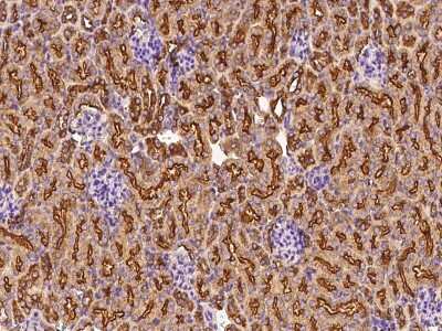 Immunohistochemistry-Paraffin: Clathrin Heavy Chain 1/CHC17 Antibody [NBP2-99436]