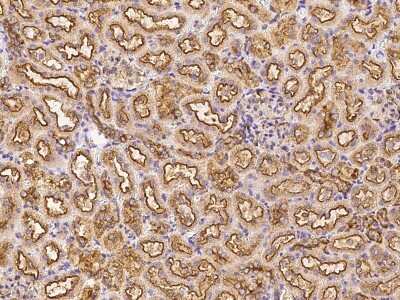Immunohistochemistry-Paraffin: Clathrin Heavy Chain 1/CHC17 Antibody [NBP2-99436]