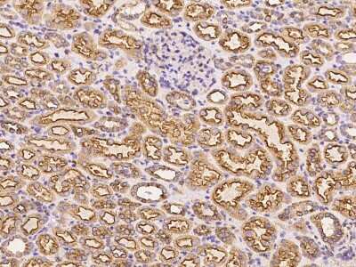 Immunohistochemistry-Paraffin: Clathrin Heavy Chain 1/CHC17 Antibody [NBP2-99436]