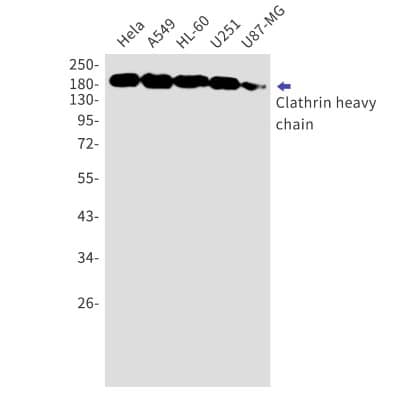 Western Blot: Clathrin Heavy Chain 1/CHC17 Antibody (S02-6C4) [NBP3-19848]