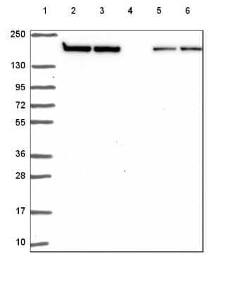 Western Blot: Clathrin Heavy Chain 1/CHC17 Antibody [NBP2-49293]