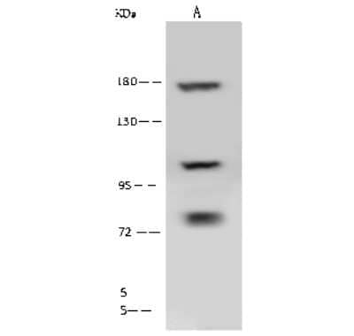 Western Blot: Clathrin Heavy Chain 1/CHC17 Antibody [NBP2-99308]