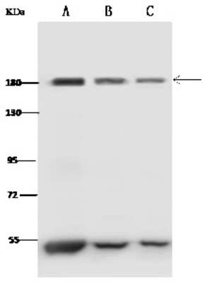 Western Blot: Clathrin Heavy Chain 1/CHC17 Antibody [NBP2-99436]