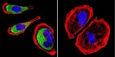Immunocytochemistry/ Immunofluorescence: Clathrin Heavy Chain 1/CHC17 Antibody (X22) - BSA Free [NB300-613]