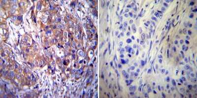 Immunohistochemistry-Paraffin: Clathrin Heavy Chain 1/CHC17 Antibody (X22) - BSA Free [NB300-613]