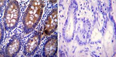 Immunohistochemistry-Paraffin: Clathrin Heavy Chain 1/CHC17 Antibody (X22) - BSA Free [NB300-613]