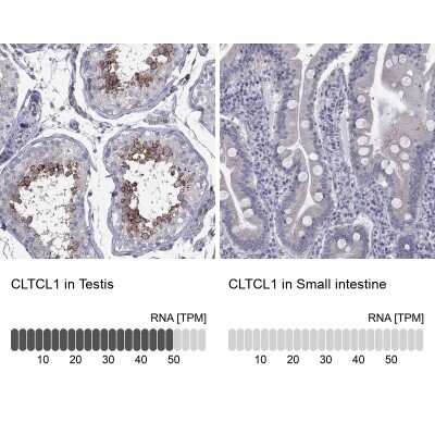 Immunocytochemistry/ Immunofluorescence: Clathrin Heavy Chain 2/CHC22/CLTCL1 Antibody [NBP3-17077]