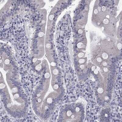 Immunohistochemistry-Paraffin: Clathrin Heavy Chain 2/CHC22/CLTCL1 Antibody [NBP3-17077]