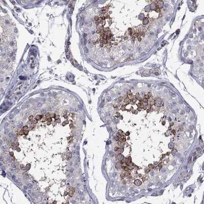 Immunohistochemistry-Paraffin: Clathrin Heavy Chain 2/CHC22/CLTCL1 Antibody [NBP3-17077]