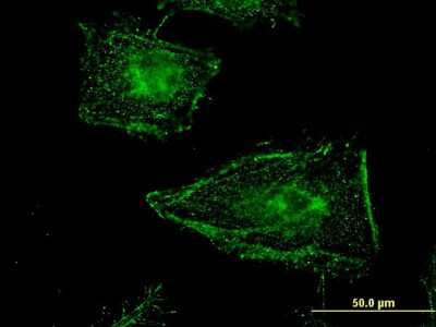 Immunocytochemistry/ Immunofluorescence: Clathrin interactor 1 Antibody (1E6) [H00009685-M03]