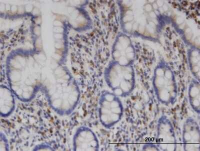 Immunohistochemistry-Paraffin: Clathrin interactor 1 Antibody (1E6) [H00009685-M03]