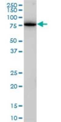 Western Blot: Clathrin interactor 1 Antibody (1E6) [H00009685-M03]