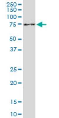 Western Blot: Clathrin interactor 1 Antibody (1E6) [H00009685-M03]