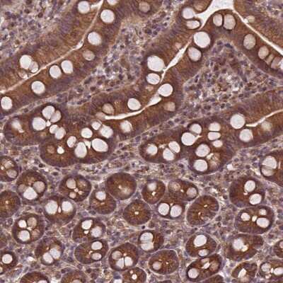 Immunohistochemistry: Clathrin interactor 1 Antibody [NBP2-49239]