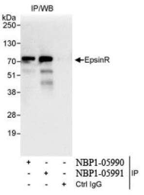 Immunoprecipitation: Clathrin interactor 1 Antibody [NBP1-05990]