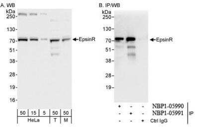 Western Blot: Clathrin interactor 1 Antibody [NBP1-05991]