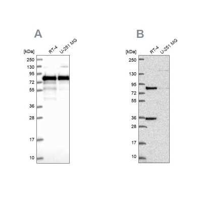 Western Blot: Clathrin interactor 1 Antibody [NBP1-85570]