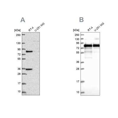 Western Blot: Clathrin interactor 1 Antibody [NBP2-49239]