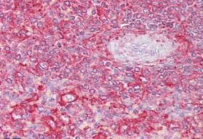 Immunohistochemistry-Paraffin: Clathrin light chain + heavy chain Antibody [NBP1-05035]