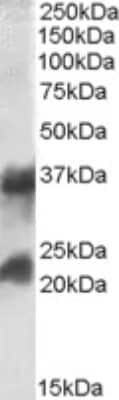 Western Blot: Clathrin light chain + heavy chain Antibody [NBP1-05035]