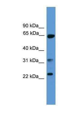 Western Blot: Clathrin light chain + heavy chain Antibody [NBP1-69194]