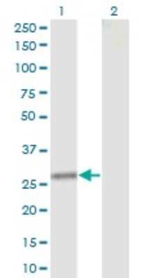 Western Blot: Clathrin light chain Antibody (4D5) [H00001211-M12]