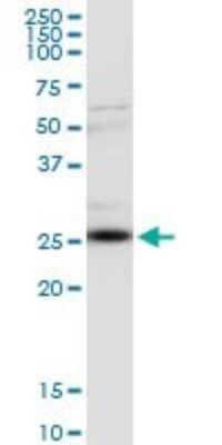 Western Blot: Clathrin light chain Antibody (4E9) [H00001211-M08]