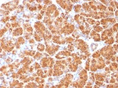 Immunohistochemistry-Paraffin: Clathrin light chain Antibody (CLC/1421) [NBP2-53231]