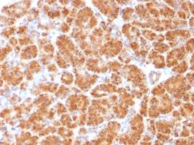 Immunohistochemistry-Paraffin: Clathrin light chain Antibody (CLC/1421) - Azide and BSA Free [NBP2-54436]