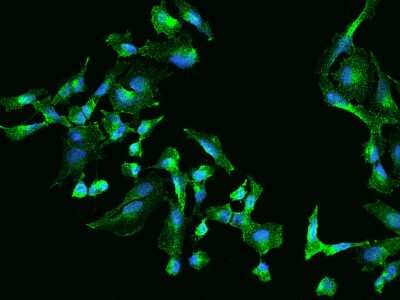 Immunocytochemistry/ Immunofluorescence: Clathrin light chain Antibody [NBP2-97249]