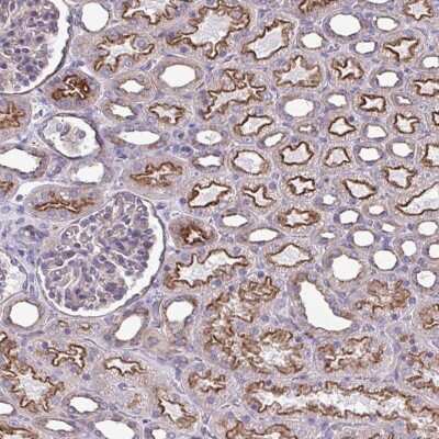 Immunohistochemistry: Clathrin light chain Antibody [NBP2-38733]
