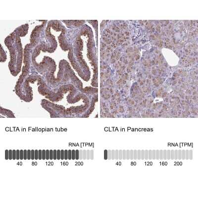 Immunohistochemistry-Paraffin: Clathrin light chain Antibody [NBP2-38638]