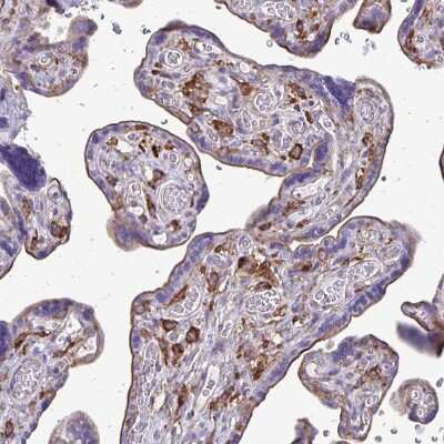 Immunohistochemistry-Paraffin: Clathrin light chain Antibody [NBP2-38638]