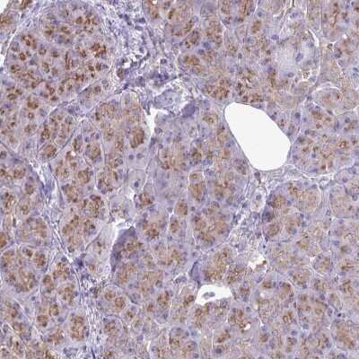 Immunohistochemistry-Paraffin: Clathrin light chain Antibody [NBP2-38638]