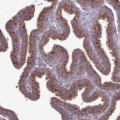 Immunohistochemistry-Paraffin: Clathrin light chain Antibody [NBP2-38638]