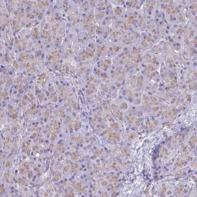 Immunohistochemistry-Paraffin: Clathrin light chain Antibody [NBP2-38733]