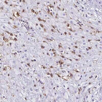 Immunohistochemistry-Paraffin: Clathrin light chain Antibody [NBP2-38733]