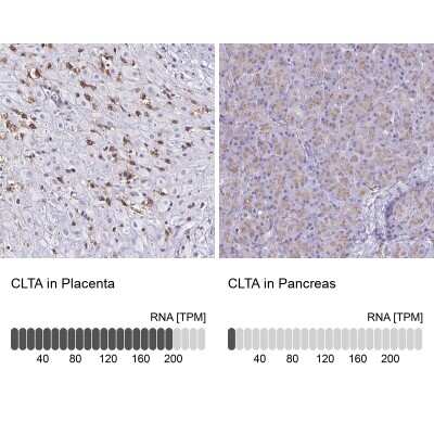 Immunohistochemistry-Paraffin: Clathrin light chain Antibody [NBP2-38733]