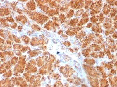 Immunohistochemistry-Paraffin: Clathrin light chain Antibody (SPM174) [NBP2-53232]