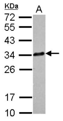 Western Blot: Clathrin light chain Antibody [NBP2-14913]
